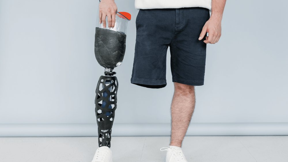 الأطراف الاصطناعية بتقنية الطباعة ثلاثية الأبعاد